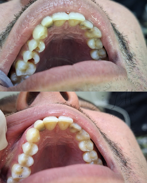 Foto 2 de Dr Luiz Henrique Oliveira - Cirurgião-Dentista SJC - Dentista em São José dos Campos
