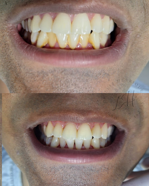 Foto 3 de Dr Luiz Henrique Oliveira - Cirurgião-Dentista SJC - Dentista em São José dos Campos