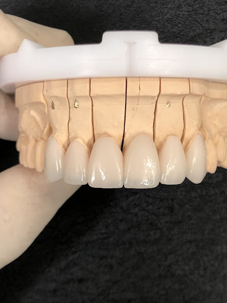 Foto 3 de Dr. Luiz Otávio Breier - Harmonização Orofacial