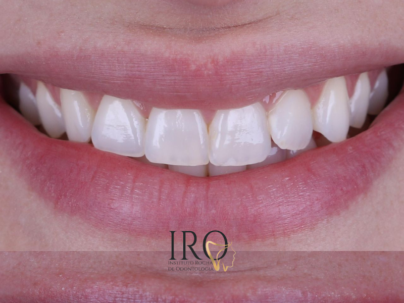 Foto 3 de Dr. Luiz Rocha | Cirurgião Dentista