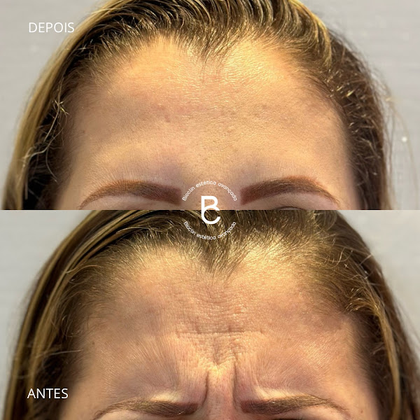 Foto 3 de Dr Magno Leal - Estética, Harmonização Facial e Emagrecimento em Cachoeiro de Itapemirim