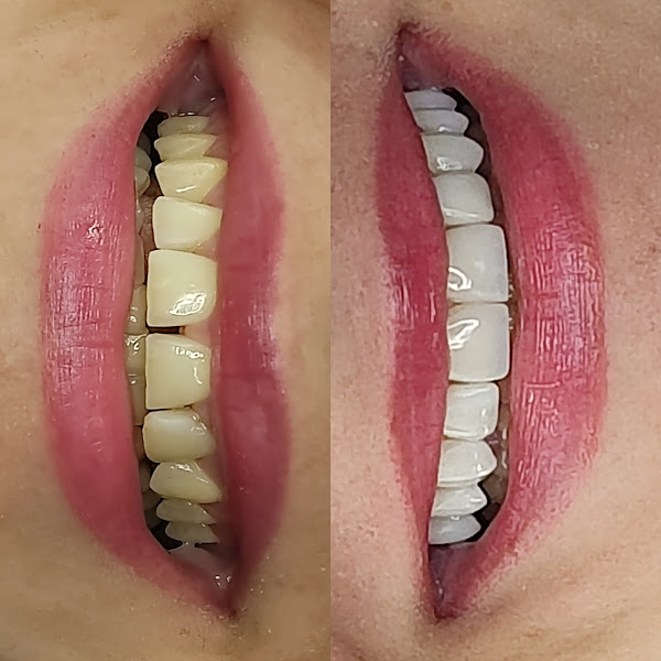 Foto 2 de Dr. Maicon Espinoza - Estética Dental