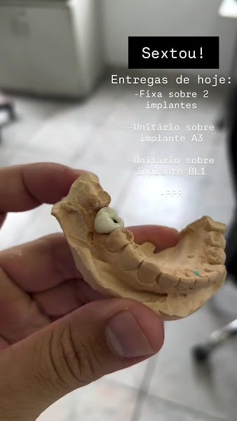 Foto 3 de Dr. Maicon Santos - Cirurgião Dentista