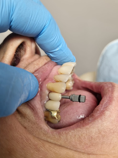 Foto 2 de Dr. Marcelo Cabral - Implantes e Cirurgia Odontológica Jacarepaguá