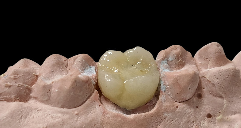 Foto 3 de Dr Marcelo Feres Sorrir Mais Dentista Vila Isabel