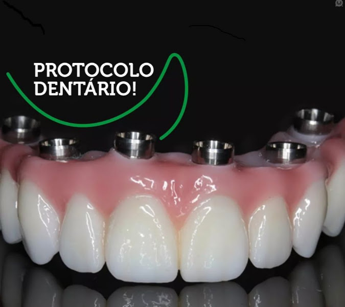 Foto 2 de Dr Marcelo Martins Pinto - Dentista