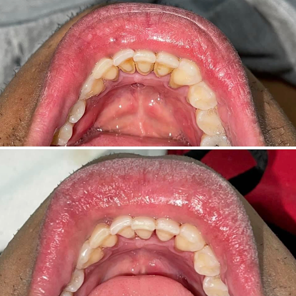 Foto 3 de Dr. Marcelo Nunes Braga - Plantão 24 h. - Dentista Varginha