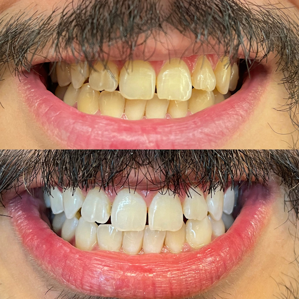 Foto 3 de Dr Marcelo Paiva | Harmonização Facial e Odontologia Estética em Caucaia
