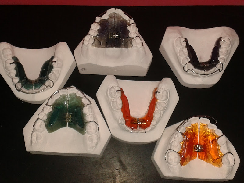 Foto 3 de Dr. Marcelo Reis - Odontologia especializada