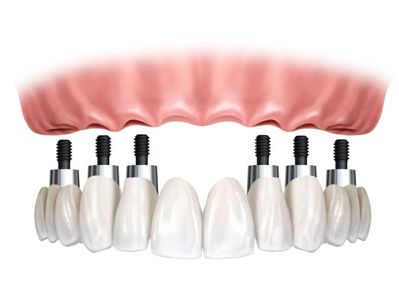 Foto de Dr. Marcelo Rissio - Cirurgião Dentista