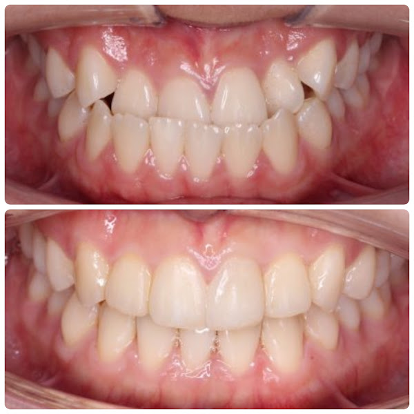 Foto 3 de Dr. Marcelo Trino - Dra. Simone Canelas - Equipe Odonto Alcance