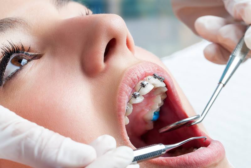 Foto 2 de Dr. Marcelo Ximenes Dentista Ortodontia Lentes e Facetas em Resinas Compostas Rio das Ostras