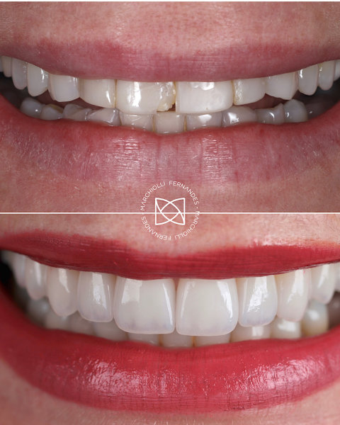 Foto 2 de Dr. Marchiolli Fernandes - Cirurgião Dentista