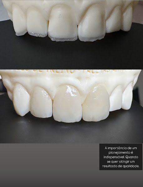 Foto 2 de Dr. Marcílio Leite
