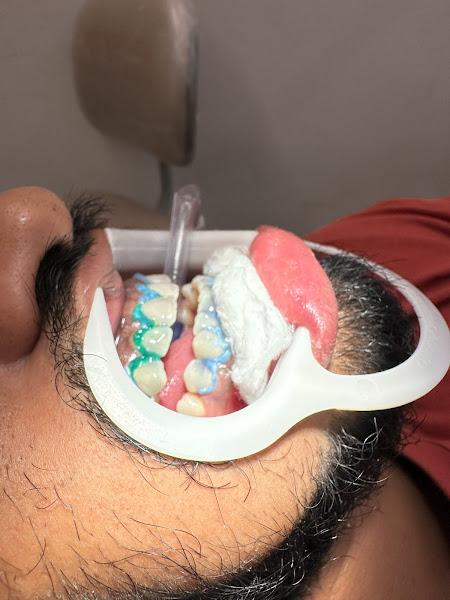 Foto 3 de Dr. Marcílio Leite