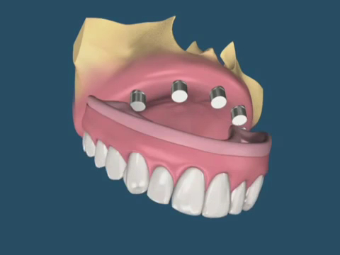 Foto 3 de Dr. Márcio Francci Dentista - Odontologia | Periodontia | Implantes | Protocolo