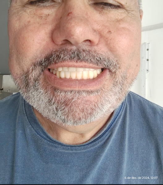 Foto 3 de Dr. Marcio Ota - Odontologia Especializada