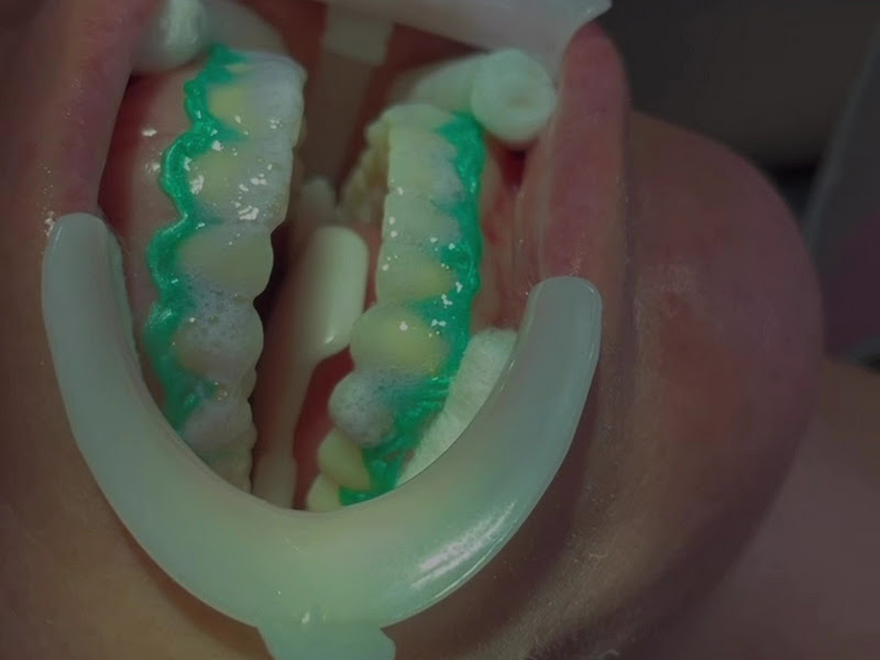 Foto 2 de Dr. Marco Antônio Rosa, Dentista