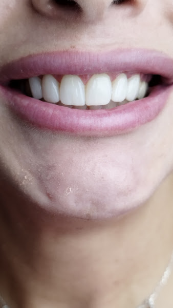 Foto 3 de Dr.Marcone Monteiro - Dentista em Guarulhos