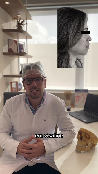Foto 3 de Dr. Marcos Adriano da Silveira - BUCOMAXILOFACIAL Ortognática - Mentoplastia - ATM