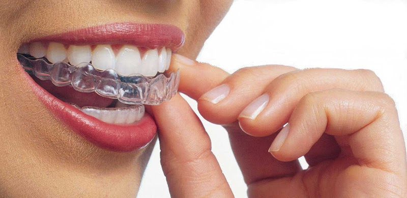 Foto 3 de Dr. Marcos de Borba - Clínica Revéri | Lipo de Papada I Harmonização Facial I Ortodontia