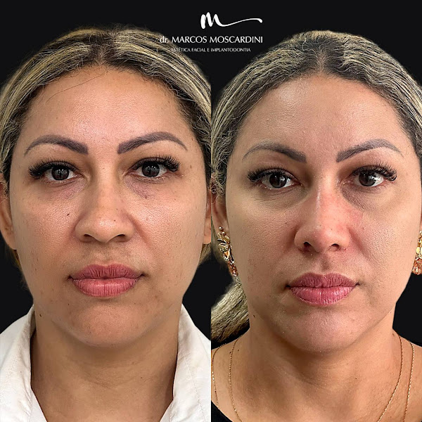 Foto 3 de DR MARCOS MOSCARDINI