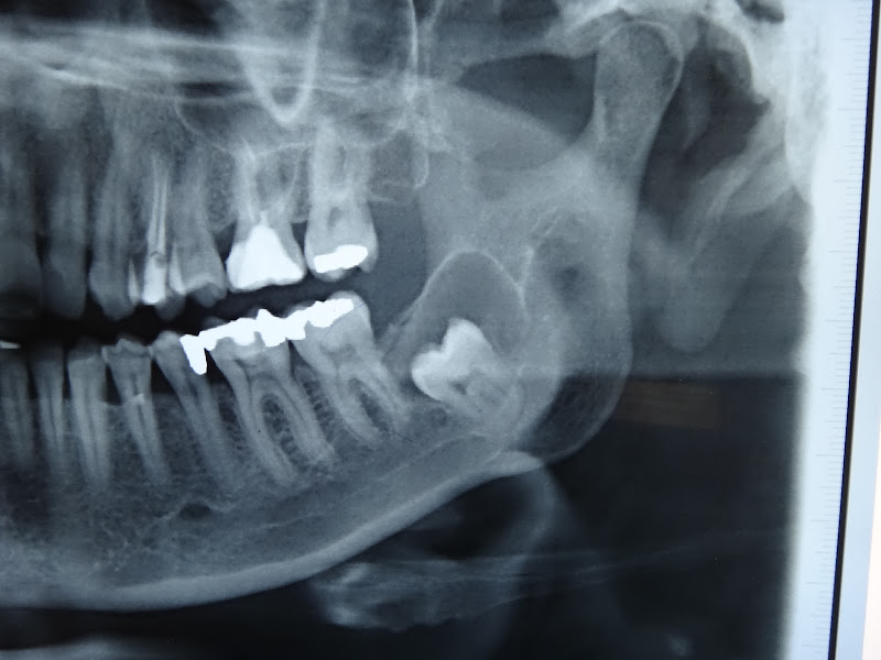 Foto 3 de Dr. Marcos Vinício Buco