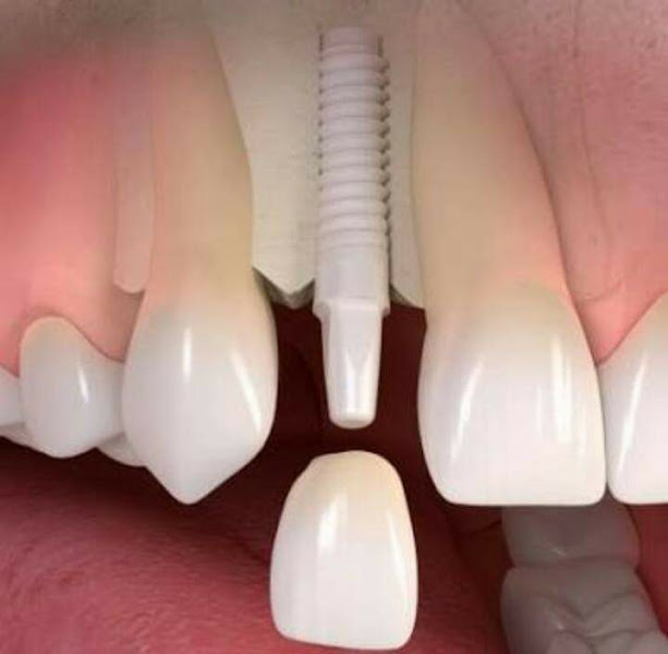 Foto 3 de Dr.MarcosJacobovitz Odontologia S/S