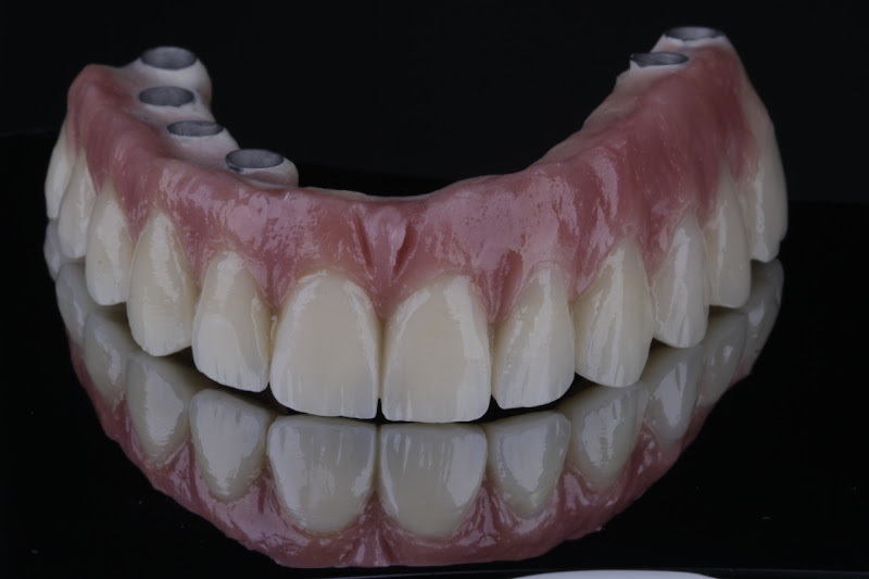 Foto 3 de Dr. Marcus Perpetuo | Dentista