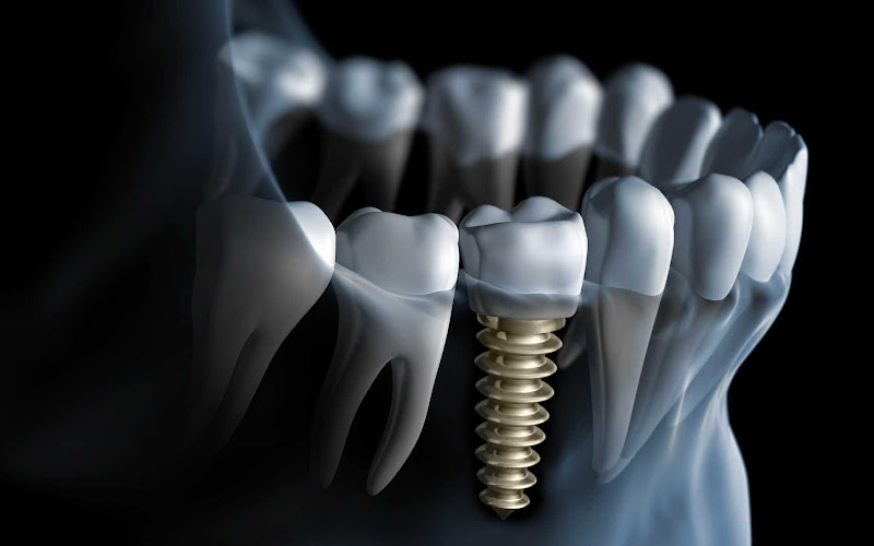 Foto 2 de Dr. Marcus Senne - Odontoimplantes LTDA
