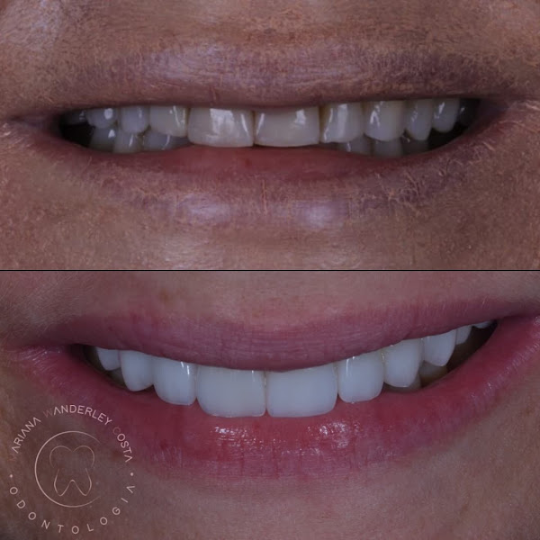Foto 3 de Drª Mariana Wanderley Costa - Cirurgiã-dentista