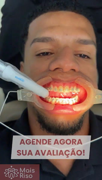 Foto 3 de Drª Marilia Rafaela | Ortodontista | Aparelho Invisível SouSmile | Invisalign® Doctor | Recreio dos Bandeirantes