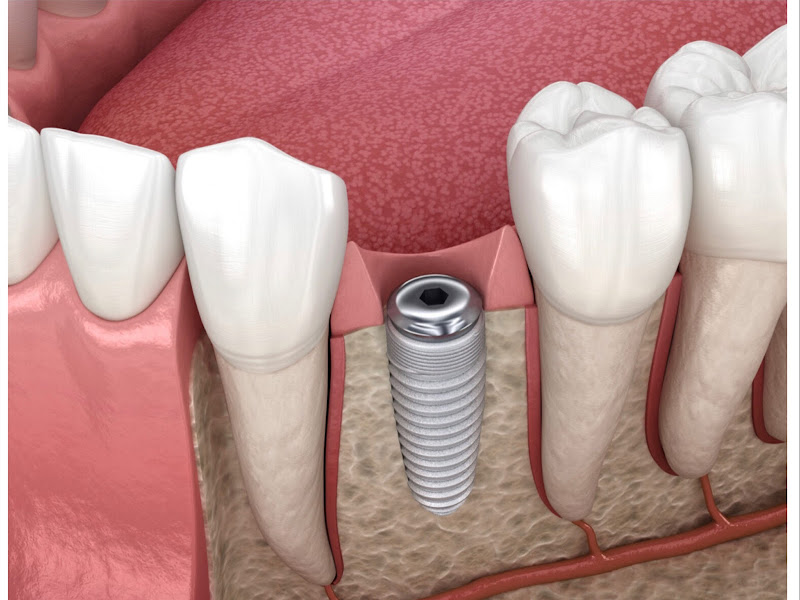 Foto 4 de DRª Marina Favrin - Consultório Odontológico