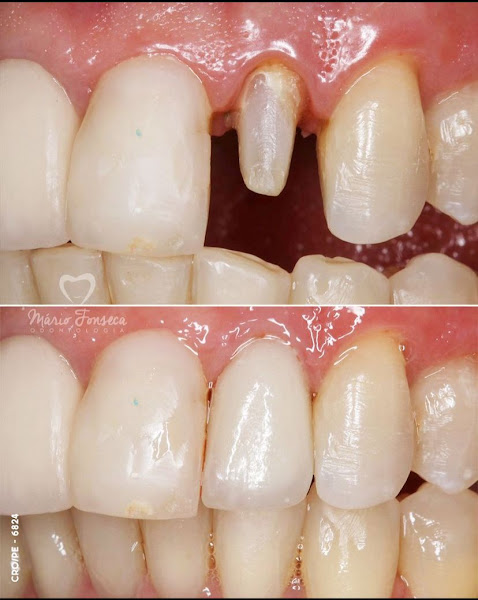 Foto 5 de Dr. Mário Fonseca Odontologia