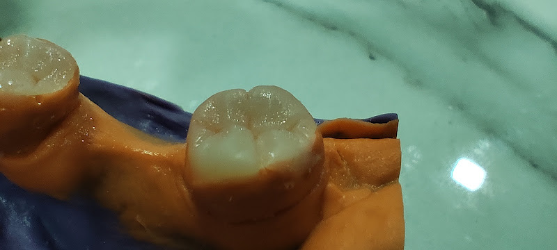 Foto 2 de Dr Marques Filho - Endodontista