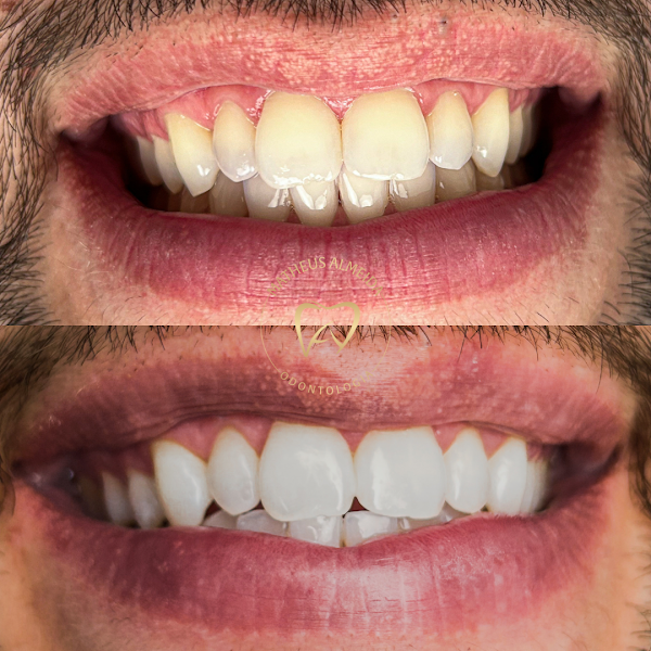 Foto 3 de Dr. Matheus Almeida | Dentista em Volta Redonda