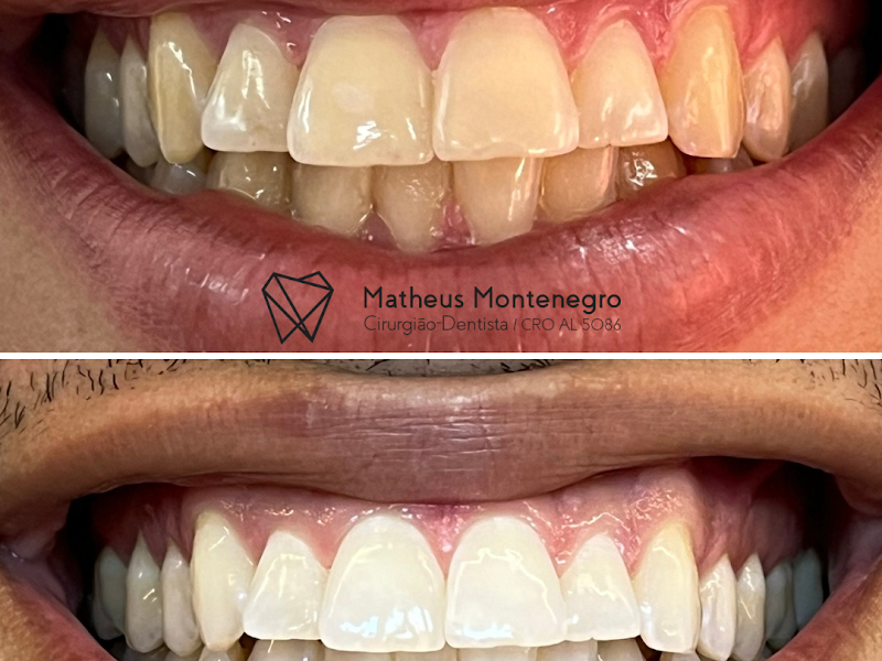 Foto 6 de Dr. Matheus Freire | Dentista Maceió