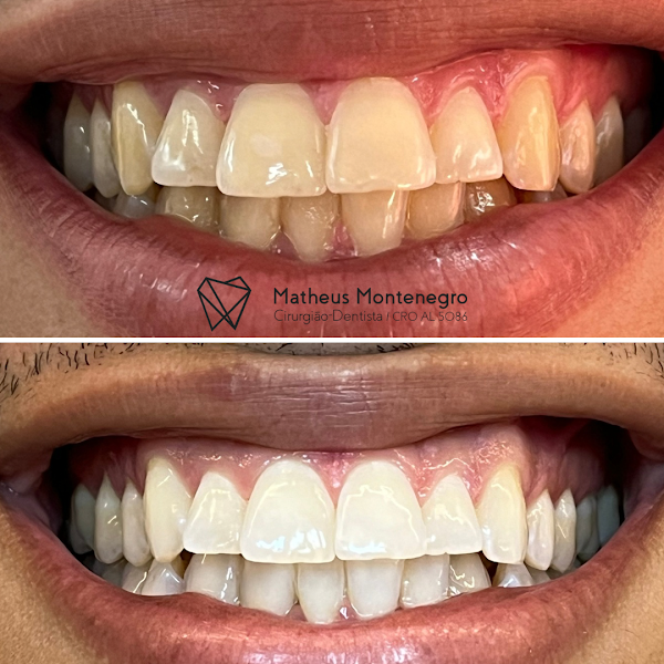 Foto 2 de Dr. Matheus Montenegro - DENTISTA MACEIÓ