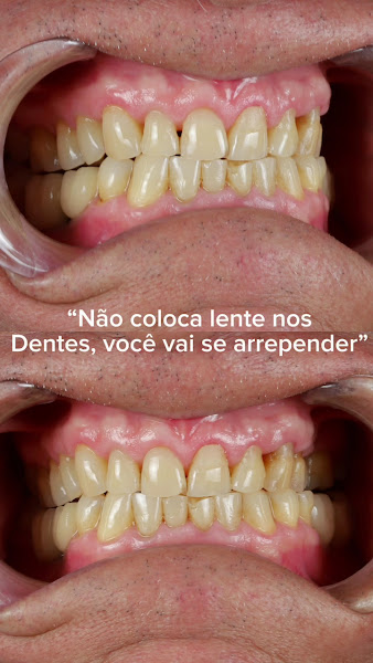 Foto 3 de Dr. Matheus Paiva Odontologia