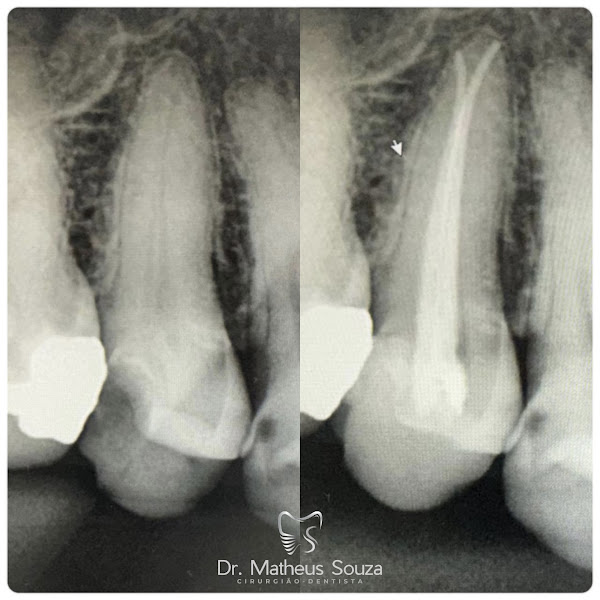 Foto 3 de Dr. Matheus Souza - Urgência Dentista 24h