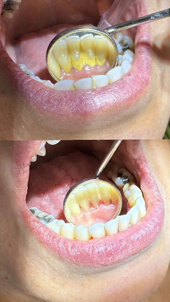 Foto 3 de Dr. Maurício Mollar - Cirurgião-Dentista