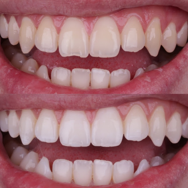 Foto 2 de Dr Michael - Dentista - São José dos Campos