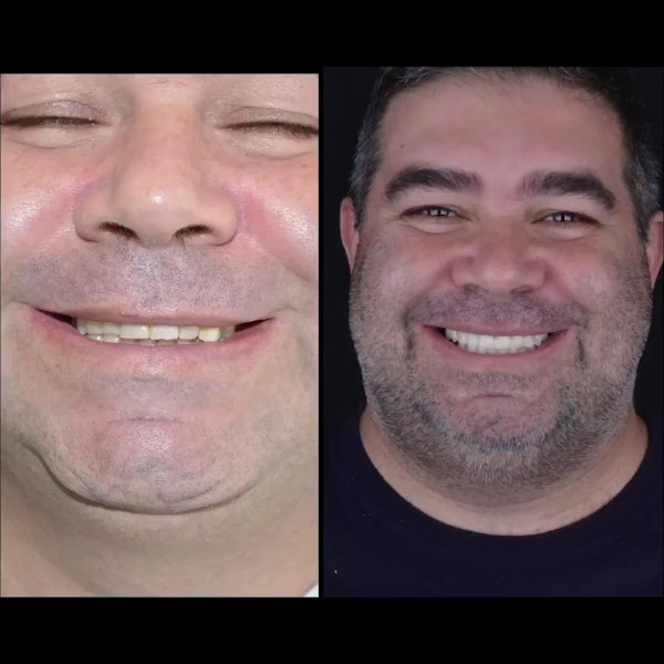 Foto 3 de Dr. Michel Cunha - Dentista / Reabilitação do Sorriso