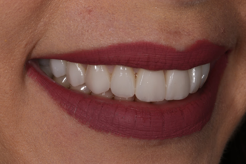 Foto 2 de Dr. Miguel Angelo Nogueira – Cirurgião Dentista Implantodontista - Petropolis RJ