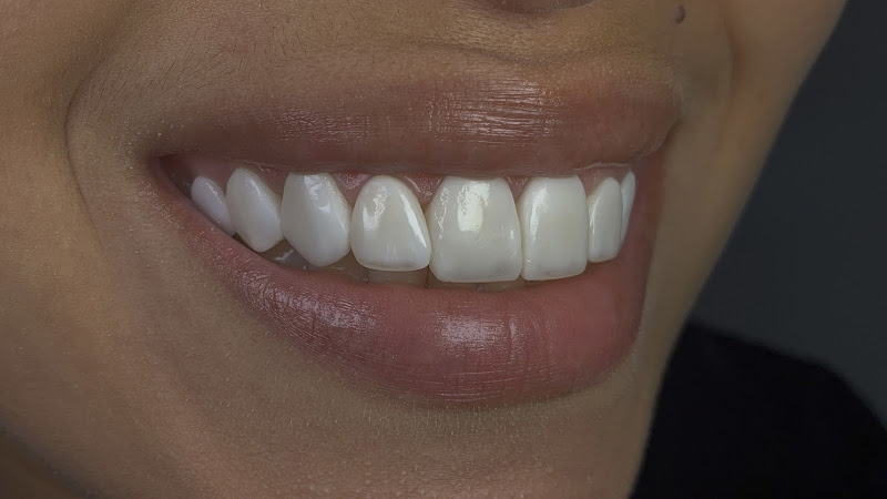 Foto 2 de Dr Miguel Odontologia estética