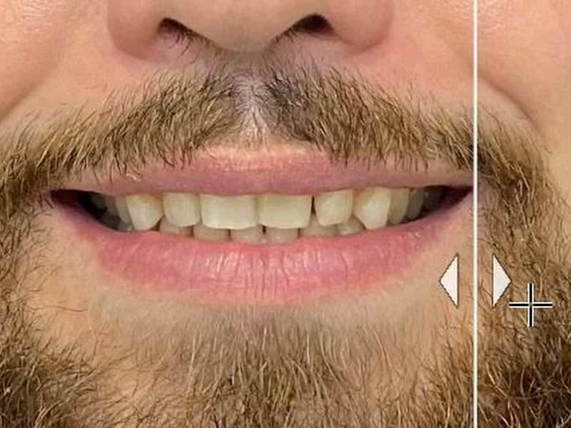 Foto 3 de Dr. Misael Guimarães/ Implantes|DTM| Lente de contato| Canal