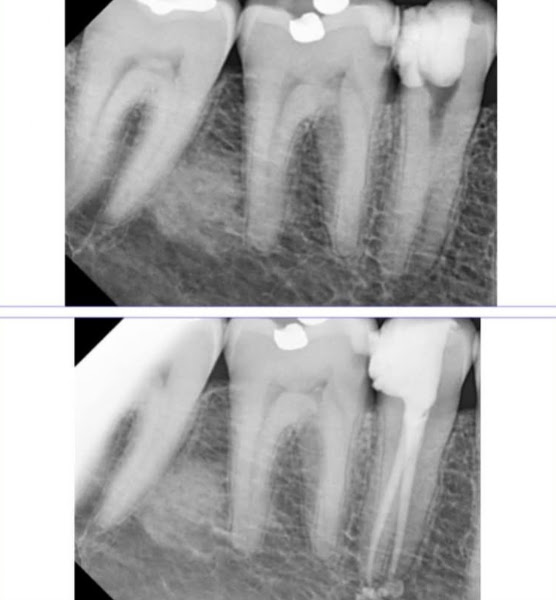 Foto 3 de Dr. Murillo Barreto Endodontia Especializada