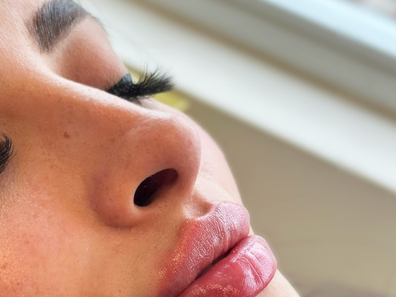 Foto 2 de Dr. Murilo do Valle Harmonização Facial