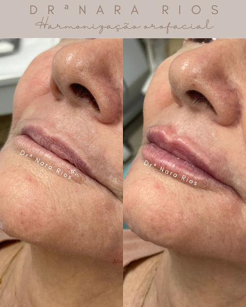 Foto 3 de Drª Nara Rios, Odontologia Estética