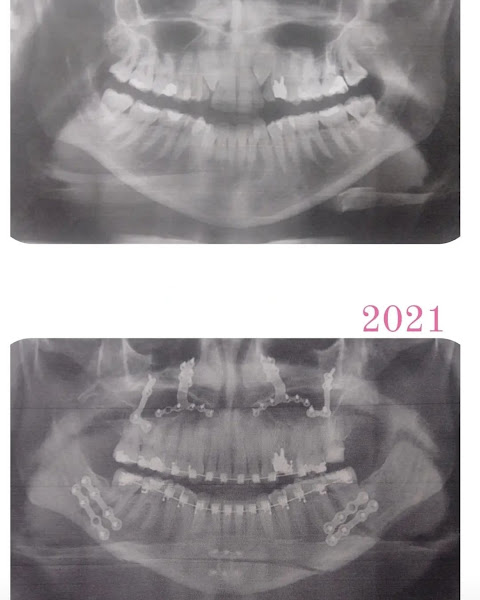 Foto 3 de Dr. Odilon Mendes | Invisalign Doctor Santos/São Vicente